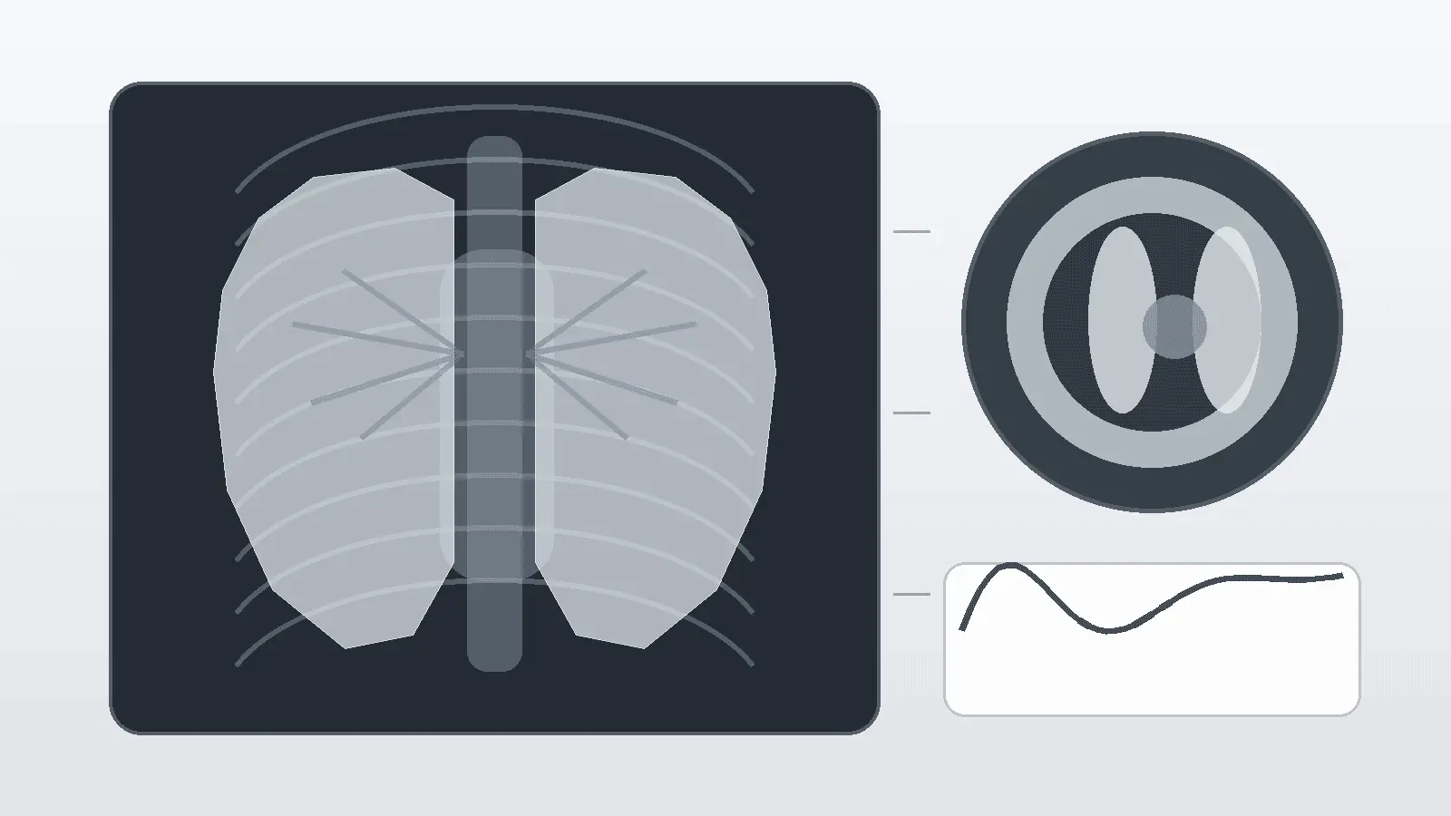 Stylised chest imaging illustration showing lungs, mediastinum and a CT cross-section.